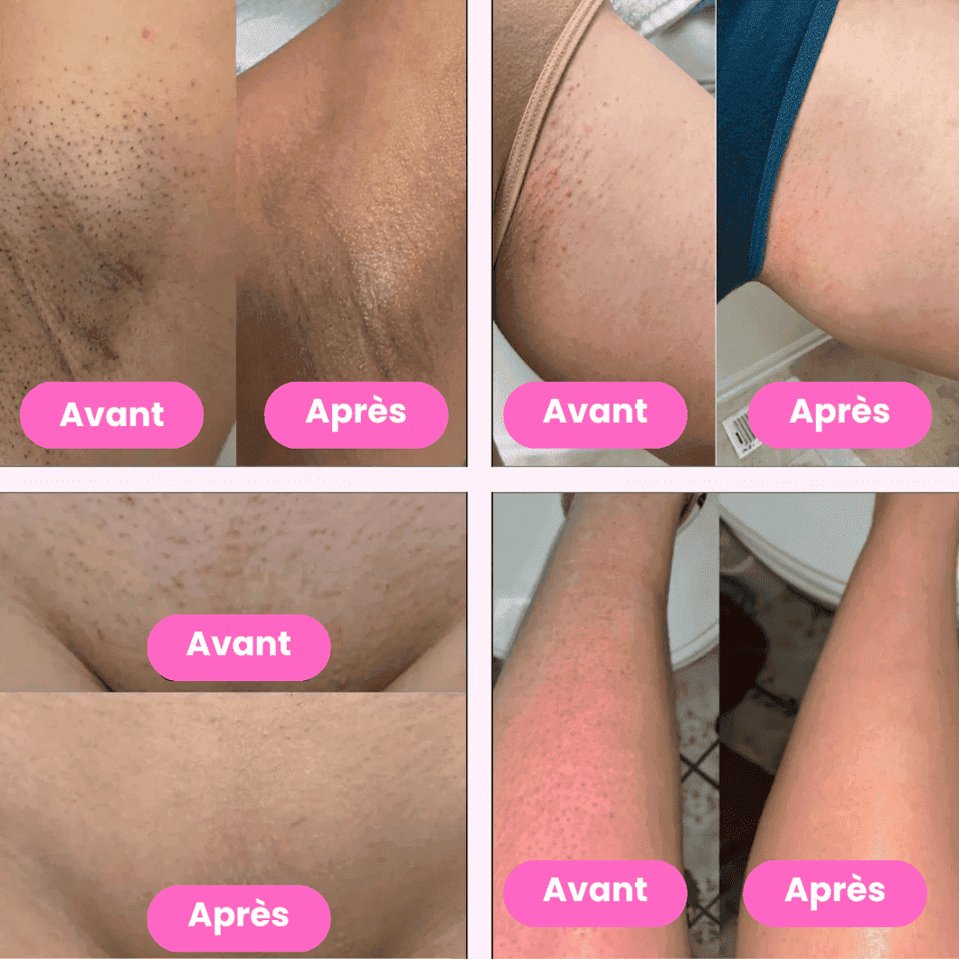 Veluna Glow™ — Épilateur Douceur 2-en-1